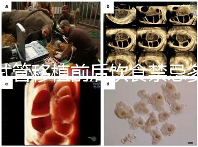 試管移植前后飲食禁忌多，十大不利于胚胎著床的水果別亂吃