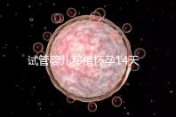 試管嬰兒移植懷孕14天,還能吃巧克力餅干嗎?