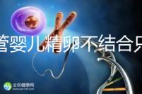 試管嬰兒精卵不結(jié)合只是基因問(wèn)題?這幾大原因告知真相