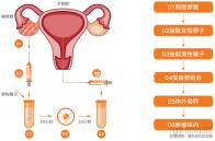 試管嬰兒內(nèi)幕(揭秘試管嬰兒)