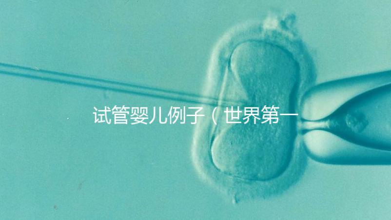 試管嬰兒例子(世界第一例試管嬰兒)