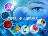 試管嬰兒促排卵需要多少錢-促排藥多少錢一個療程