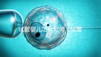 試管嬰兒怎樣取卵(試管嬰兒怎樣取卵視頻)