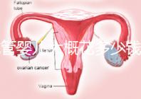 試管嬰兒大概花多少錢(qián)(試管嬰兒大概花多少錢(qián)費(fèi)用)