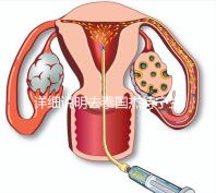 詳細說明去泰國杰特寧生殖中心做第三代試管技術的五大優勢，幫助你克服生育問題，快速隱藏！