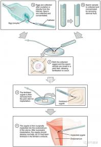 貴陽單身女性禁止凍卵？持“三證”已婚女性就能凍卵