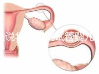 誰說華西二院試管嬰兒成功率不高，那是你沒選對生殖醫生