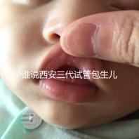 誰說西安三代試管包生兒子多少錢看醫(yī)院，能不能做還兩說