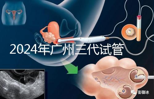 2024年廣州三代試管嬰兒費(fèi)用明細(xì)公布！