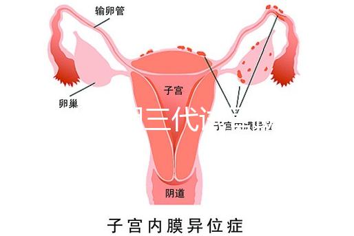 2025昆明三代試管助孕機構收費明細，價格8萬至15萬不等