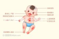 les試管嬰兒干貨來了!女同加拿大免費(fèi)生娃指南