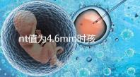 nt值為4.6mm時(shí)孩子也能要,判斷胎兒畸形不能太草率